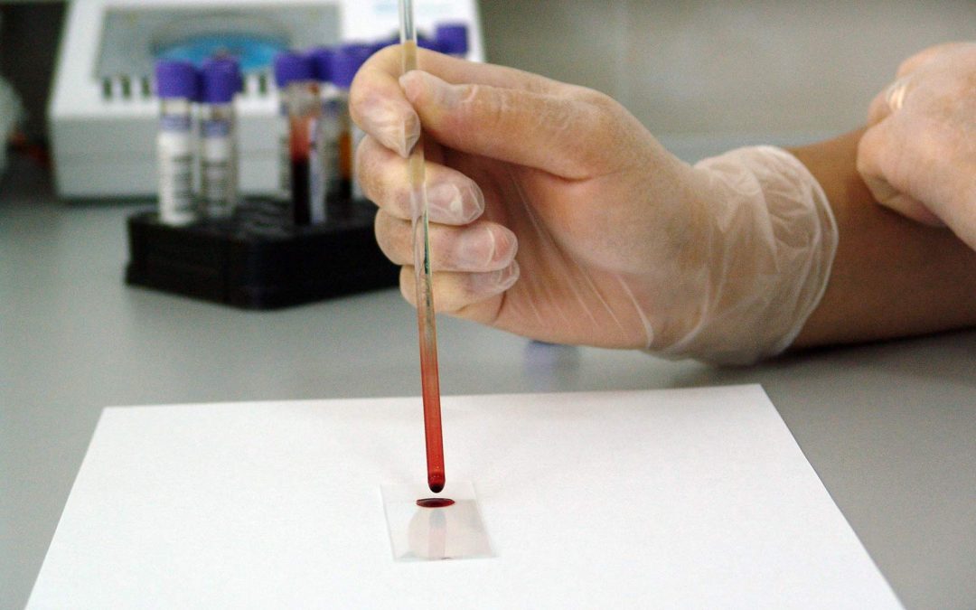 Un fármaco contra el cáncer de colon