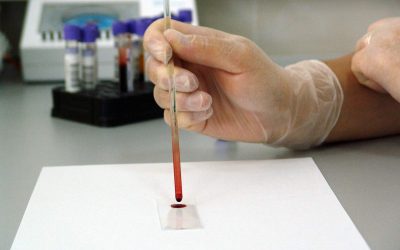 Un fármaco contra el cáncer de colon